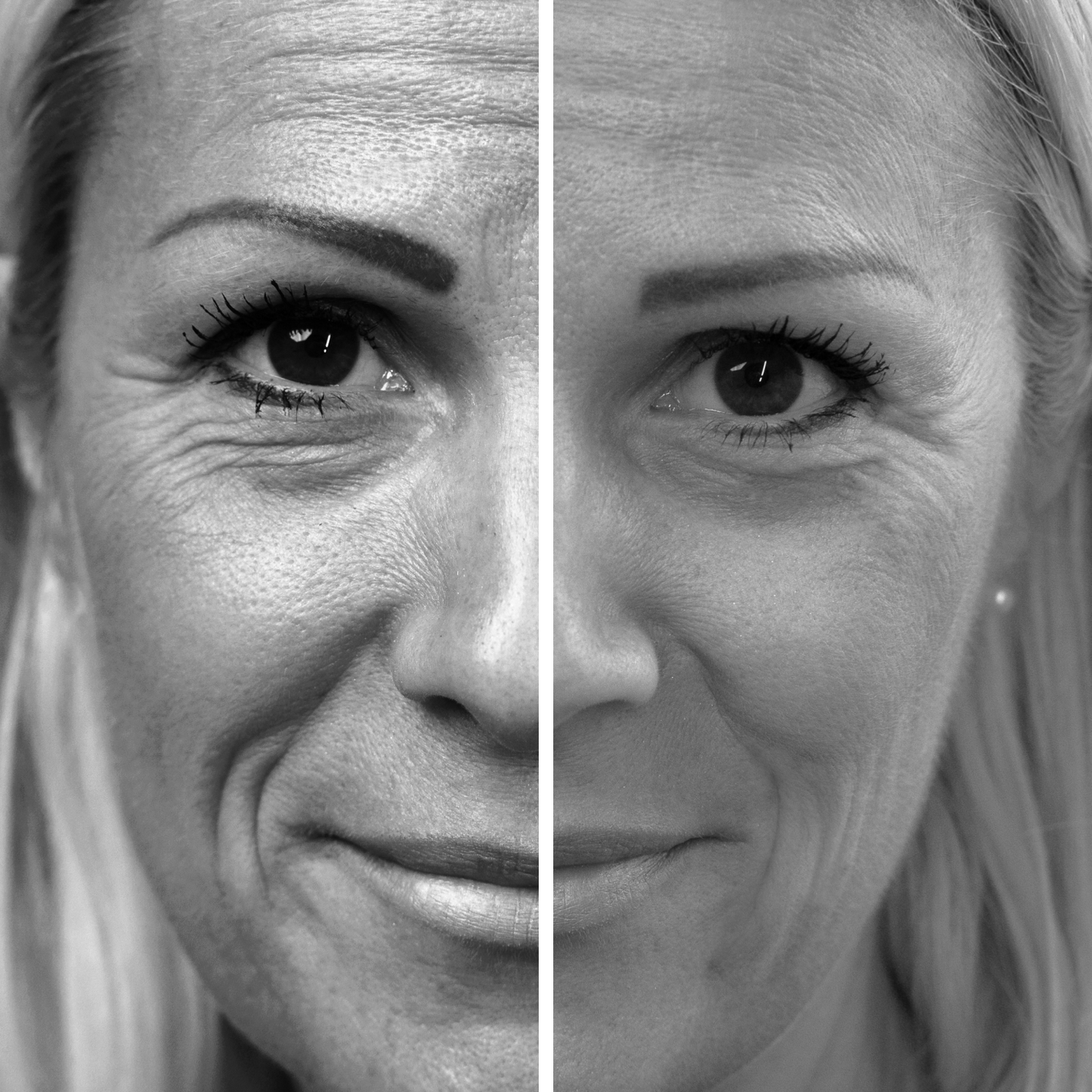 probaskin collagen shots
